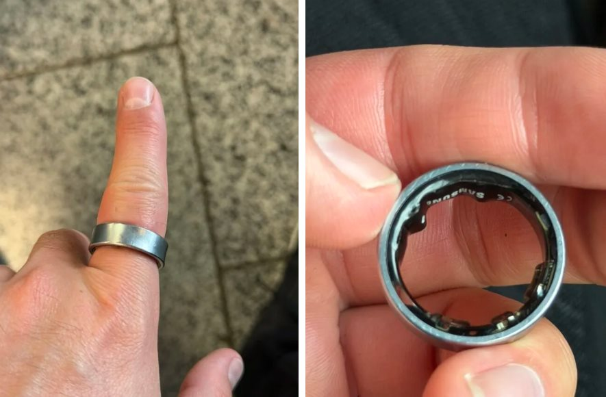 Người dùng hốt hoảng khi một sản phẩm của Samsung phồng pin, kẹt luôn trên ngón tay: "Vừa đau vừa sợ nổ"- Ảnh 1.