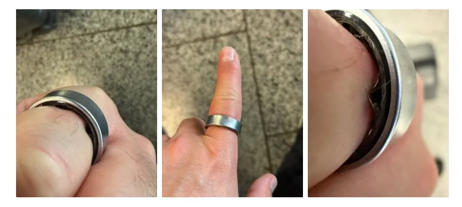 Người dùng hốt hoảng khi một sản phẩm của Samsung phồng pin, kẹt luôn trên ngón tay: "Vừa đau vừa sợ nổ"- Ảnh 2.