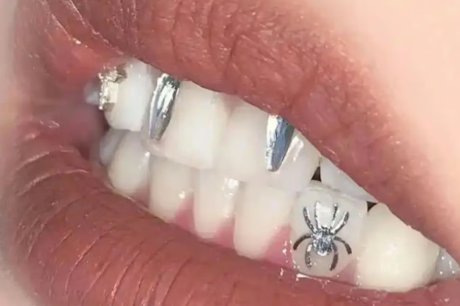 Sốc với mốt "xăm răng" ở Trung Quốc: Giới trẻ khắc chữ "làm giàu", "thành công" ngay trên răng- Ảnh 3.
