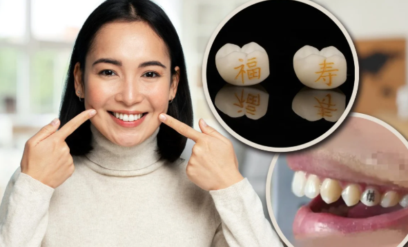 Sốc với mốt "xăm răng" ở Trung Quốc: Giới trẻ khắc chữ "làm giàu", "thành công" ngay trên răng- Ảnh 2.