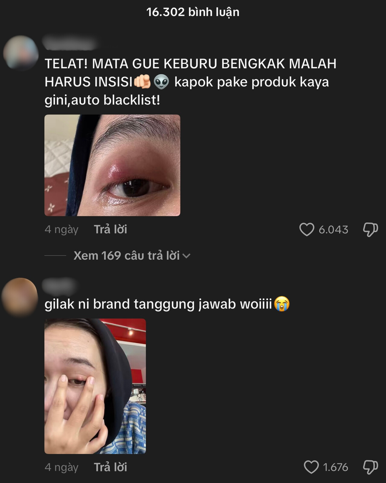 Phấn mắt PINKFLASH dính bê bối lớn: Người dùng bị lẹo mắt hàng loạt, hãng tiêu huỷ, đền tiền gấp đôi- Ảnh 10. Phấn mắt PINKFLASH dính bê bối lớn: Người dùng bị lẹo mắt hàng loạt, hãng tiêu huỷ, đền tiền gấp đôi- Ảnh 10.