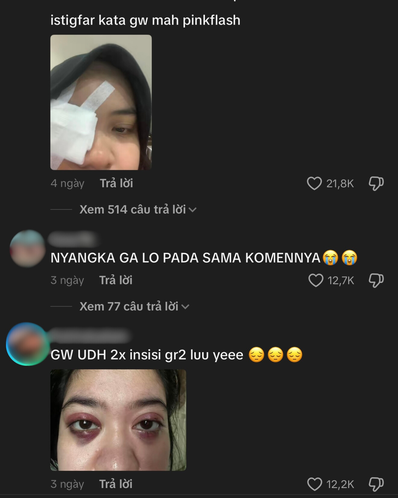 Phấn mắt PINKFLASH dính bê bối lớn: Người dùng bị lẹo mắt hàng loạt, hãng tiêu huỷ, đền tiền gấp đôi- Ảnh 13. Phấn mắt PINKFLASH dính bê bối lớn: Người dùng bị lẹo mắt hàng loạt, hãng tiêu huỷ, đền tiền gấp đôi- Ảnh 13.