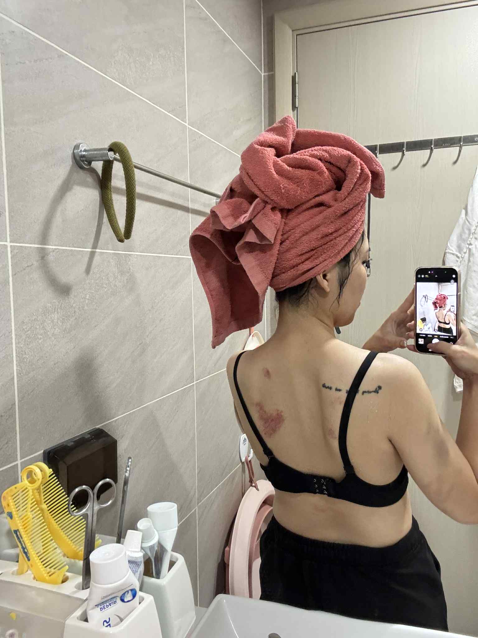 Kinh hãi cảnh chồng lôi vợ ra đánh giữa hành lang chung cư, thủng màng nhĩ, chấn động não ngay trước mắt hàng xóm- Ảnh 2.