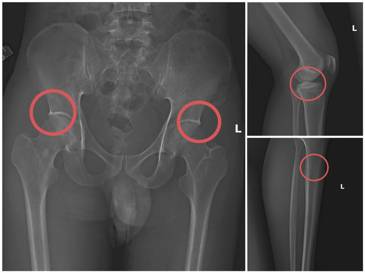 Cựu cán bộ y tế cầm đầu đường dây tự đánh vỡ xương trục lợi 6 tỷ đồng bảo hiểm- Ảnh 2.