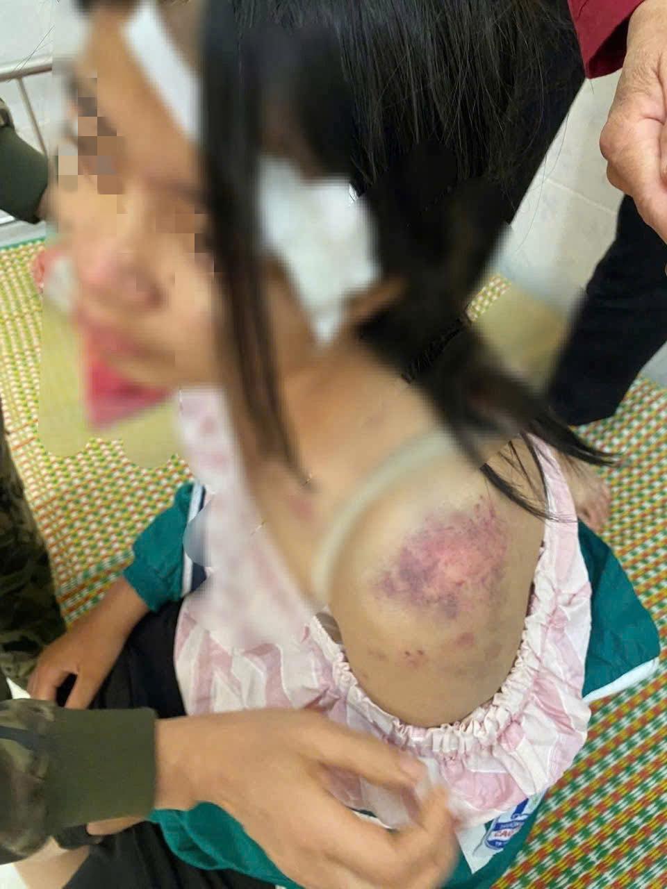 Vụ bà nội bạo hành cháu gái: Bắt Nguyễn Thị Bích Hằng sinh năm 1969- Ảnh 4.