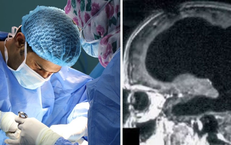 Bí ẩn về người đàn ông mất 90% não, nhưng vẫn có thể sống một cuộc sống bình thường- Ảnh 1.