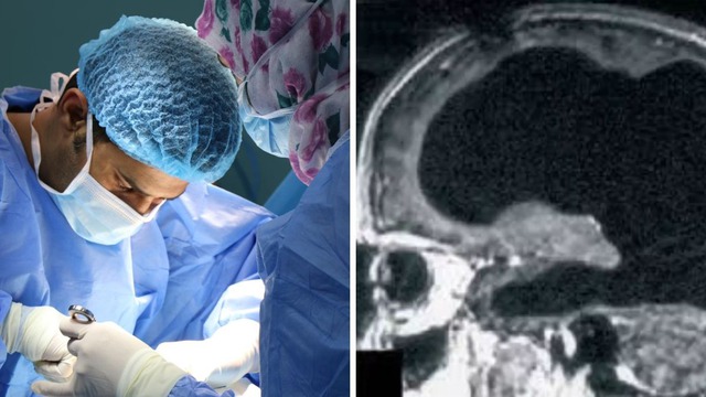 Bí ẩn về người đàn ông mất 90% não, nhưng vẫn có thể sống một cuộc sống bình thường- Ảnh 4.