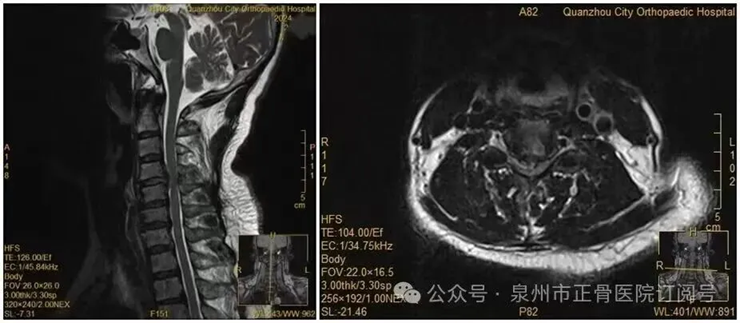 Người phụ nữ liệt nửa người vì trở mình lấy điện thoại giữa đêm: Đừng xem nhẹ những dấu hiệu cảnh báo này- Ảnh 2.