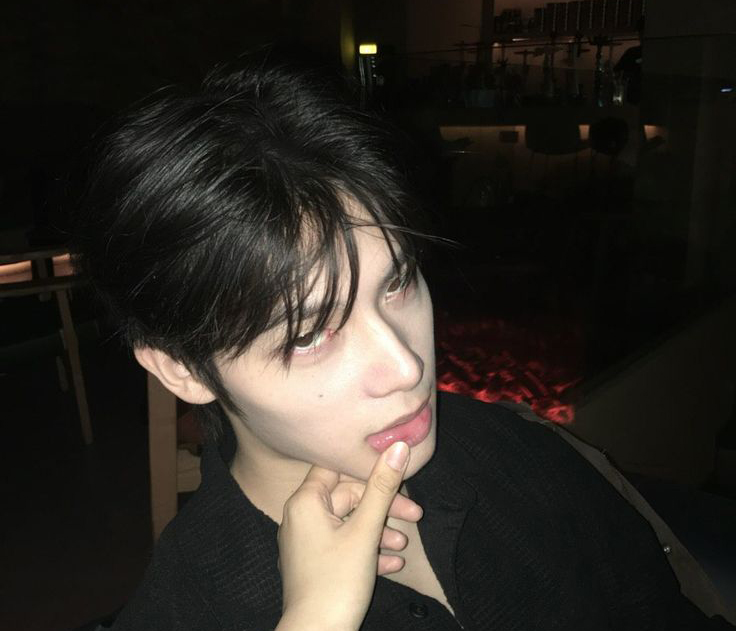 Cảnh báo: Bất kể nam hay nữ, nếu 3 thứ này trên người ngày càng “đen” chứng tỏ thận chất đầy độc tố - Ảnh 2.