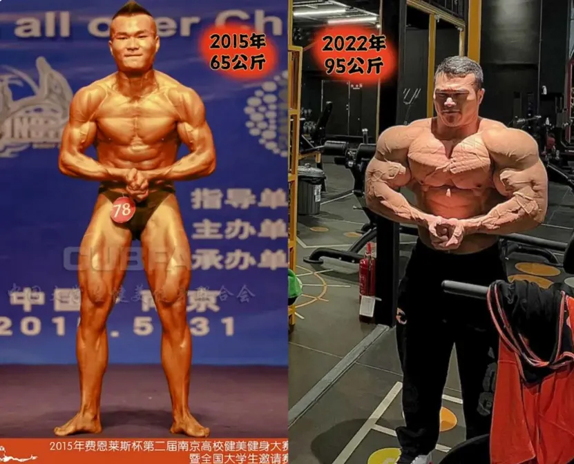 SỐC: Vận động viên thể hình 30 tuổi đột ngột qua đời vì 1 căn bệnh tưởng chỉ mắc ở người già- Ảnh 2. SỐC: Vận động viên thể hình 30 tuổi đột ngột qua đời vì 1 căn bệnh tưởng chỉ mắc ở người già- Ảnh 2.