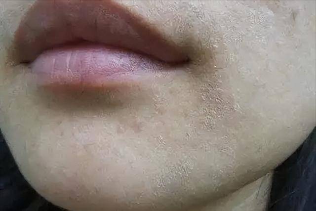 Bác sĩ đã phát hiện ra rằng người uống nước sau khi thức dậy có thể trải qua 6 thay đổi này trong cơ thể chỉ trong 3 tháng!- Ảnh 5.