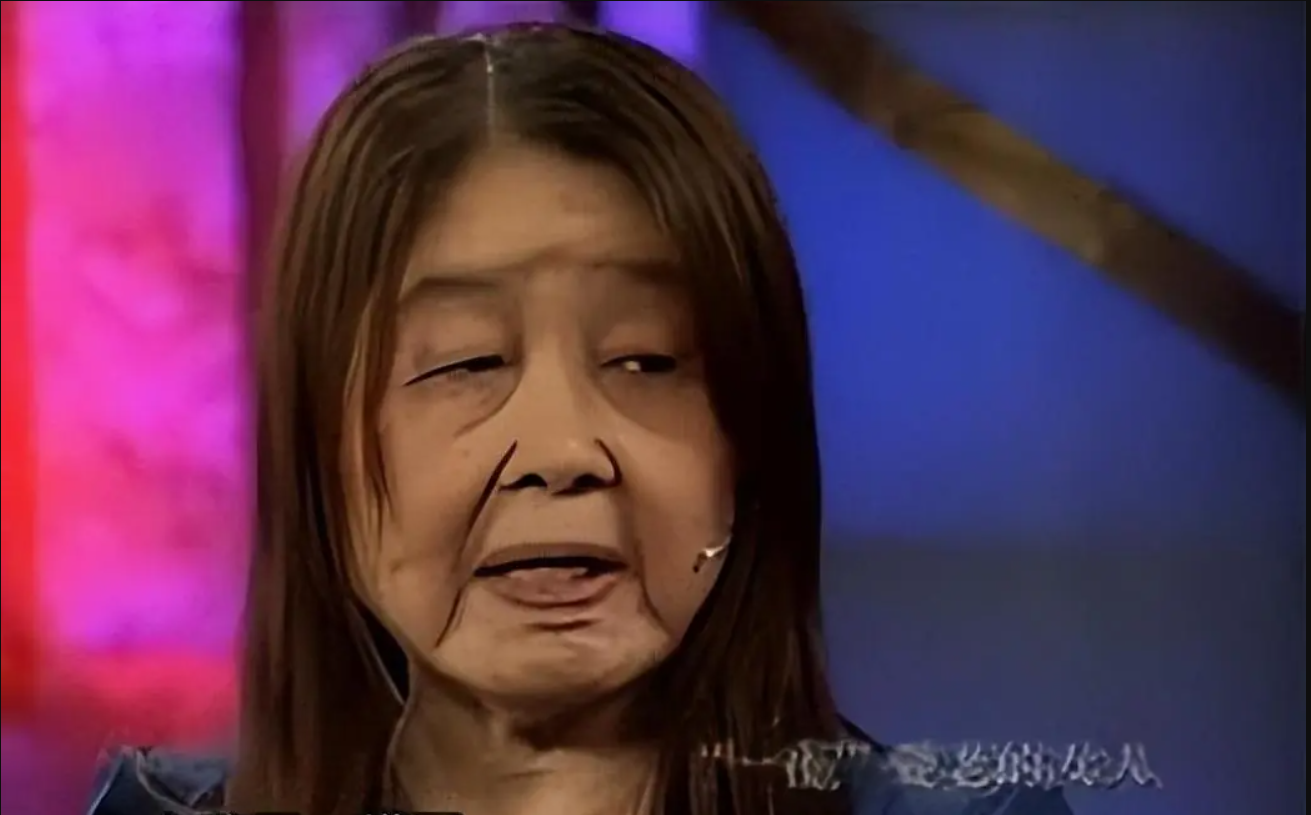 Cô gái 28 tuổi bỗng "già đi sau một đêm", bệnh viện bó tay suốt 11 năm: Sự thật khiến ai cũng rùng mình - Ảnh 4.