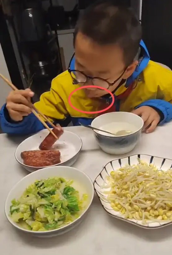 Bức ảnh ăn sáng khiến cư dân mạng tranh cãi: Nhìn môi đứa trẻ đi bố mẹ ơi, đang có vấn đề kìa!- Ảnh 1.