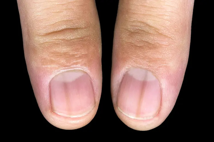 7 vị trí trên cơ thể thường chuyển sang MÀU ĐEN khi ung thư xuất hiện, tự kiểm tra ngay! - Ảnh 2.