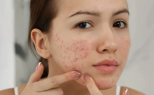 4 dấu hiệu cảnh báo bàn tay của bạn đang chứa "ổ vi khuẩn" nhiều hơn bạn tưởng, dù đã rửa sạch nhưng vẫn chứa mầm bệnh đáng sợ- Ảnh 1. 4 dấu hiệu cảnh báo bàn tay của bạn đang chứa "ổ vi khuẩn" nhiều hơn bạn tưởng, dù đã rửa sạch nhưng vẫn chứa mầm bệnh đáng sợ- Ảnh 1.