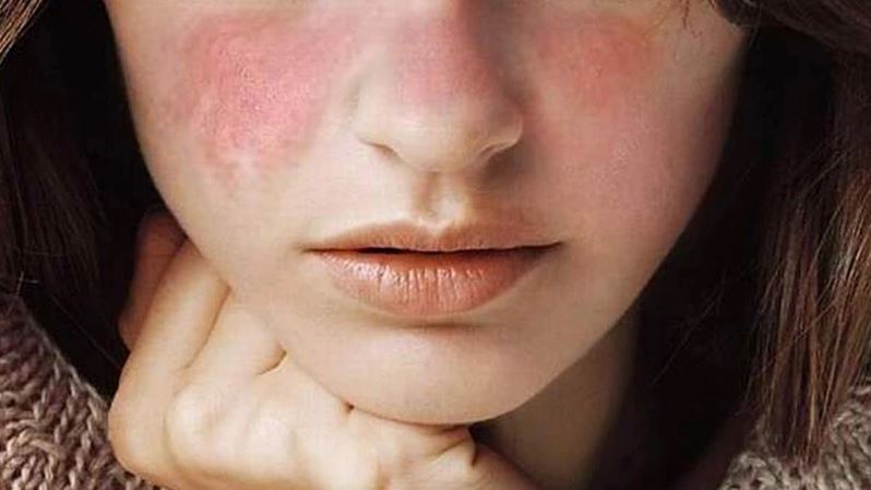 4 dấu hiệu cảnh báo bàn tay của bạn đang chứa "ổ vi khuẩn" nhiều hơn bạn tưởng, dù đã rửa sạch nhưng vẫn chứa mầm bệnh đáng sợ- Ảnh 4. 4 dấu hiệu cảnh báo bàn tay của bạn đang chứa "ổ vi khuẩn" nhiều hơn bạn tưởng, dù đã rửa sạch nhưng vẫn chứa mầm bệnh đáng sợ- Ảnh 4.