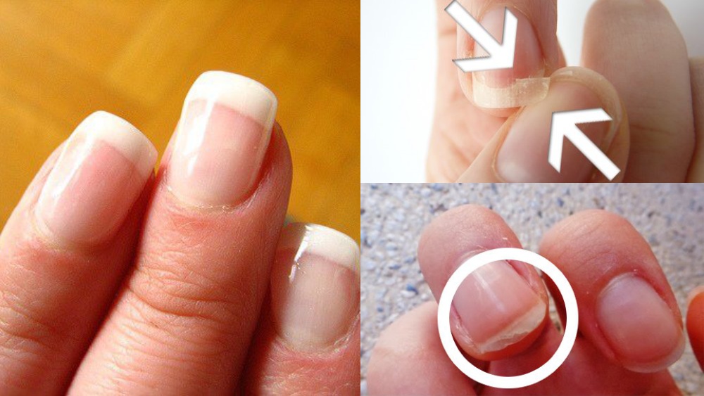Muốn biết mình đang già đi nhanh hay chậm, hãy nhìn vào 1 đặc điểm này của móng tay- Ảnh 3. Muốn biết mình đang già đi nhanh hay chậm, hãy nhìn vào 1 đặc điểm này của móng tay- Ảnh 3.