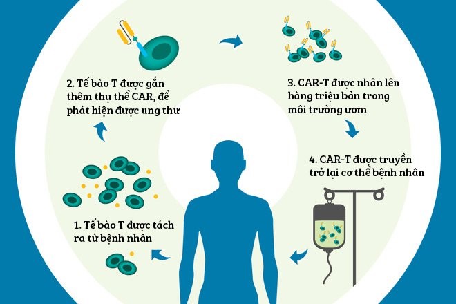 Kỷ lục: Bệnh nhân ung thư di căn xương vẫn sống khỏe sau 19 năm nhờ liệu pháp đột phá này, Việt Nam cũng có thể điều trị, giá chỉ 1,5 tỷ đồng- Ảnh 8.