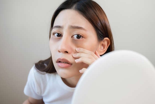 Loạt dấu hiệu trên da cho thấy gan đang suy yếu, cần đi khám ngay- Ảnh 1. Loạt dấu hiệu trên da cho thấy gan đang suy yếu, cần đi khám ngay- Ảnh 1.