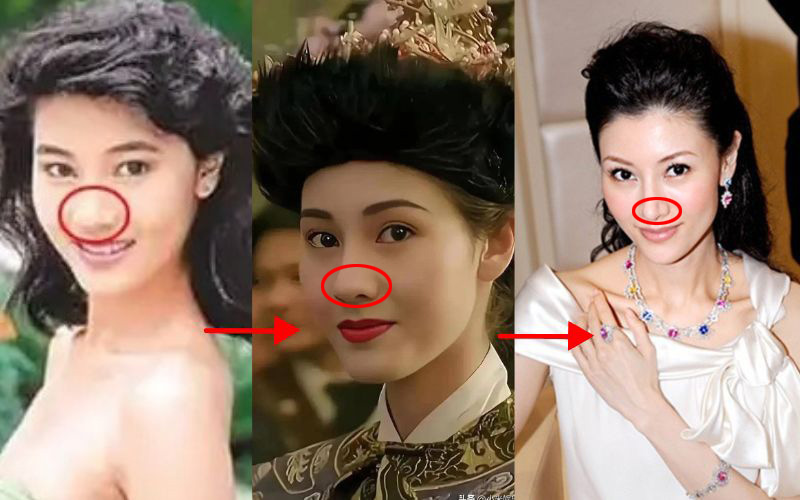 "Hoa hậu đẹp nhất" cũng phải nhờ đến "dao kéo" để tìm sự hoàn hảo, thay đổi một vị trí nâng cao tầm nhan sắc- Ảnh 3.