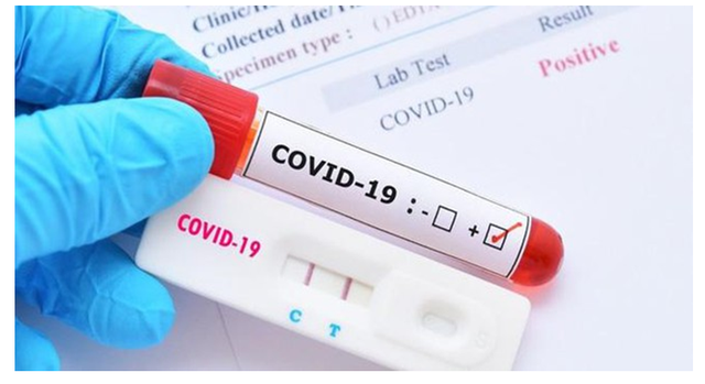 NÓNG: 83% mẫu COVID-19 tại TP HCM là biến chủng mới NB.1.8.1- Ảnh 1. NÓNG: 83% mẫu COVID-19 tại TP HCM là biến chủng mới NB.1.8.1- Ảnh 1.