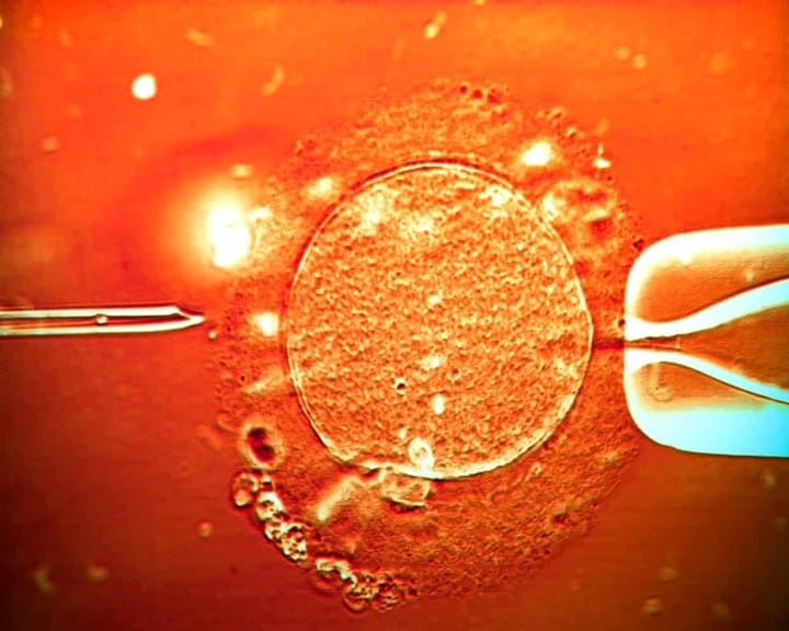 67 trẻ sinh ra từ tinh trùng người hiến mang gene ung thư, 10 trẻ mắc bệnh- Ảnh 1. 67 trẻ sinh ra từ tinh trùng người hiến mang gene ung thư, 10 trẻ mắc bệnh- Ảnh 1.