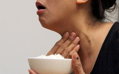 Bị nghẹn họng kéo dài tưởng bệnh dạ dày, người phụ nữ vô tình phát hiện tuyến giáp đã UNG THƯ- Ảnh 1. Bị nghẹn họng kéo dài tưởng bệnh dạ dày, người phụ nữ vô tình phát hiện tuyến giáp đã UNG THƯ- Ảnh 1.