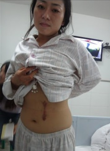 Thai phụ nhận tin 1 quả thận "mất tích" khi siêu âm: Bên giám định nghi ngờ có người can thiệp?- Ảnh 5. Thai phụ nhận tin 1 quả thận "mất tích" khi siêu âm: Bên giám định nghi ngờ có người can thiệp?- Ảnh 5.