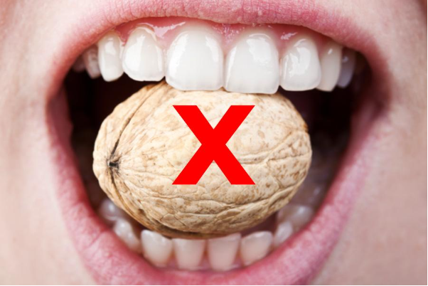 Sau khi cắm implant cần nghỉ ngơi bao lâu?- Ảnh 1.