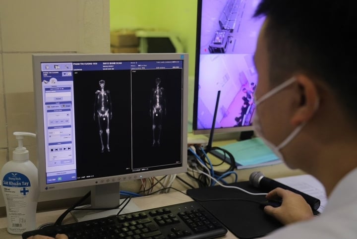 Máy xạ trị chạy 23 tiếng mỗi ngày vì quá tải bệnh nhân ung thư- Ảnh 1.