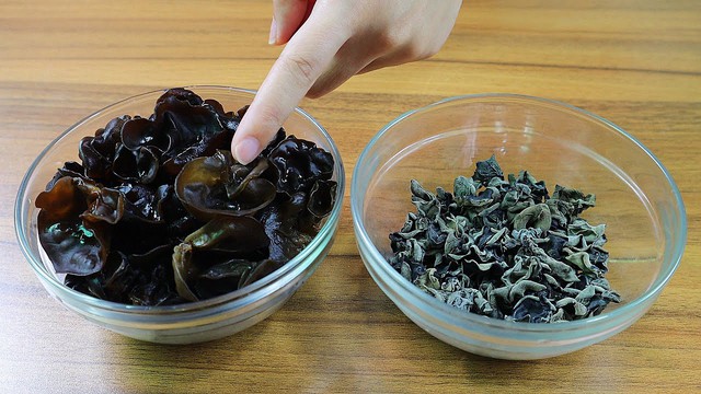 Chỉ vì 1 đĩa đồ ăn trong tủ lạnh, người phụ nữ bị suy gan cấp, phải “thay máu” cứu mạng- Ảnh 2. Chỉ vì 1 đĩa đồ ăn trong tủ lạnh, người phụ nữ bị suy gan cấp, phải “thay máu” cứu mạng- Ảnh 2.
