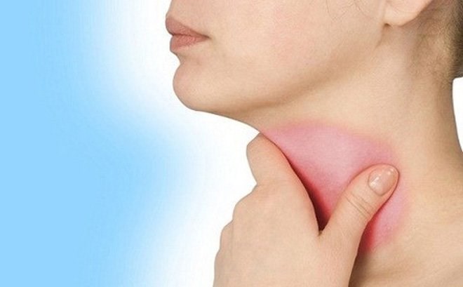 Thói quen ăn uống tưởng chừng vô hại âm thầm phá hủy tế bào, gia tăng nguy cơ ung thư thực quản- Ảnh 3. Thói quen ăn uống tưởng chừng vô hại âm thầm phá hủy tế bào, gia tăng nguy cơ ung thư thực quản- Ảnh 3.