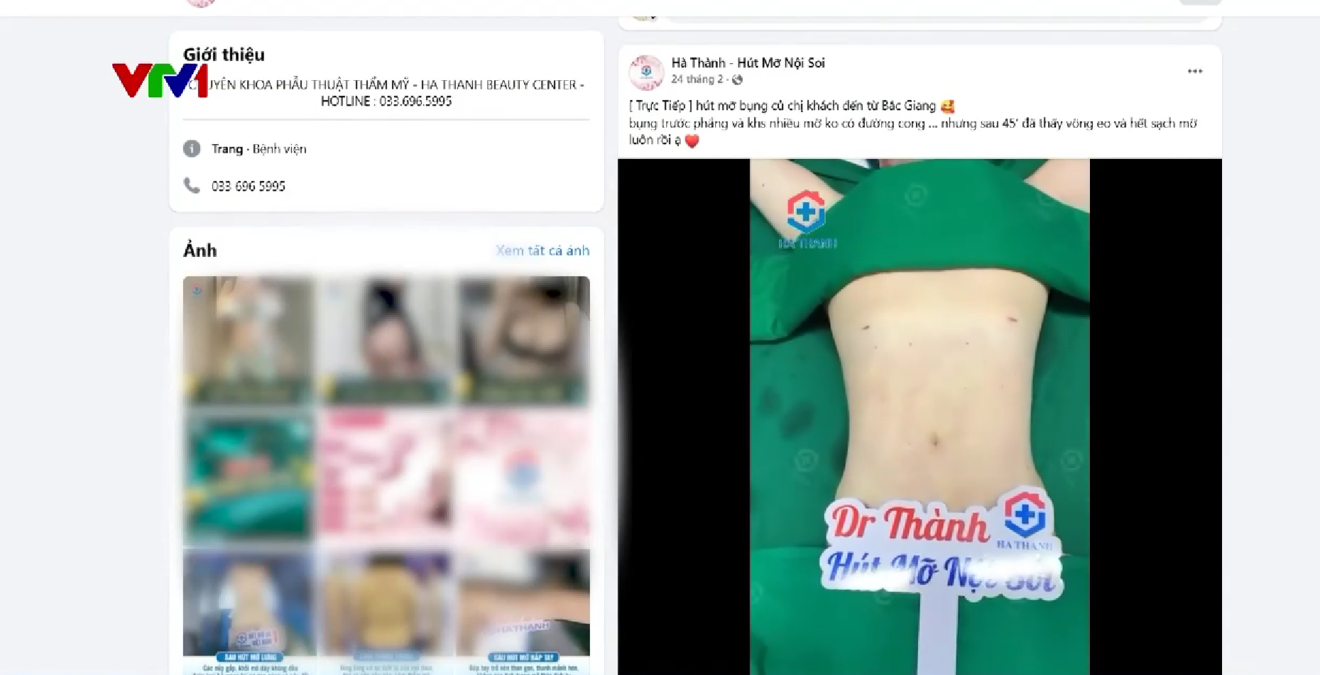 Hà Nội: Phát hiện cơ sở thẩm mỹ trái phép hút mỡ cho hàng trăm người- Ảnh 4. Hà Nội: Phát hiện cơ sở thẩm mỹ trái phép hút mỡ cho hàng trăm người- Ảnh 4.
