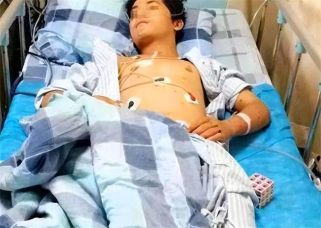 Chàng trai 17 tuổi suy thận giai đoạn cuối vì ăn quá nhiều 2 món nhưng vì Chàng trai 17 tuổi suy thận giai đoạn cuối vì ăn quá nhiều 2 món nhưng vì