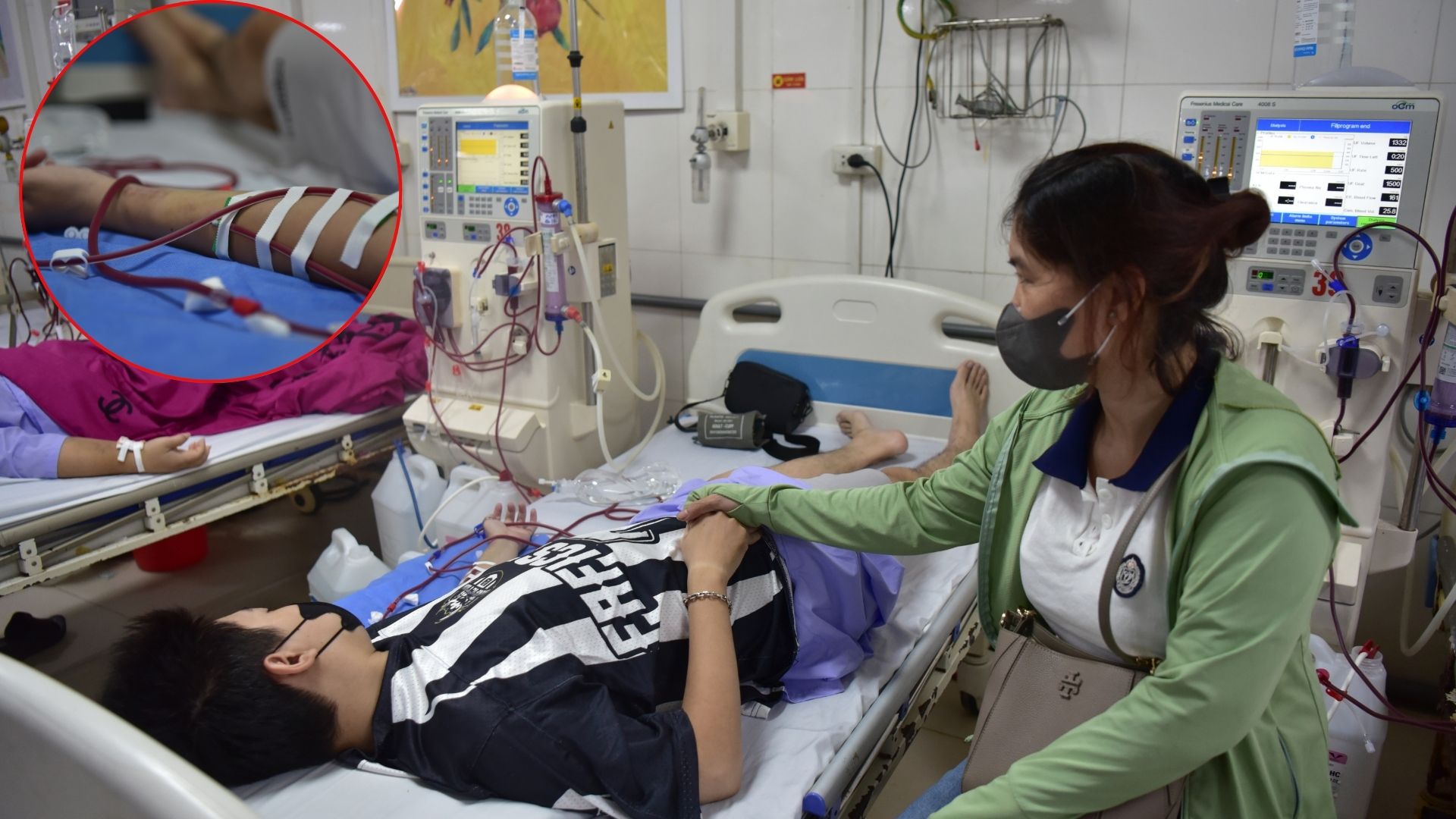24 tuổi đã suy thận giai đoạn cuối: Chỉ vì 1 sai lầm mà khiến cơ thể phải 'trả giá đắt'- Ảnh 1. 24 tuổi đã suy thận giai đoạn cuối: Chỉ vì 1 sai lầm mà khiến cơ thể phải 'trả giá đắt'- Ảnh 1.