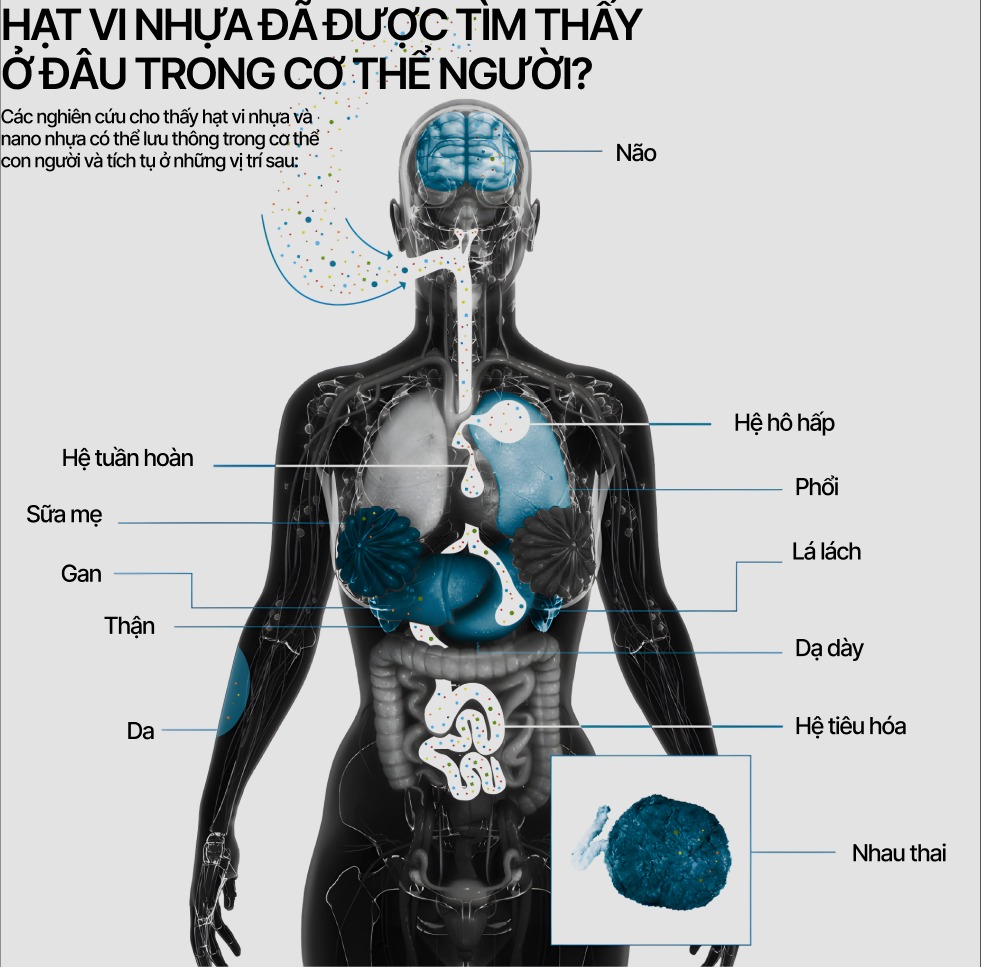Ngồi không cũng nhiễm vi nhựa - Chuyên gia cảnh báo ô nhiễm vi nhựa trong không khí, con người có thể hít vào lượng vi nhựa to bằng hươu cao cổ- Ảnh 3. Ngồi không cũng nhiễm vi nhựa - Chuyên gia cảnh báo ô nhiễm vi nhựa trong không khí, con người có thể hít vào lượng vi nhựa to bằng hươu cao cổ- Ảnh 3.