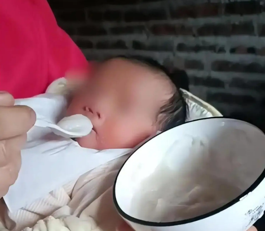 Bé gái 5 tháng tuổi đến viện với chiếc bụng toàn sỏi, bác sĩ kinh hoàng khi biết việc bố mẹ làm từ lúc bé mới sinh 3 ngày- Ảnh 3. Bé gái 5 tháng tuổi đến viện với chiếc bụng toàn sỏi, bác sĩ kinh hoàng khi biết việc bố mẹ làm từ lúc bé mới sinh 3 ngày- Ảnh 3.