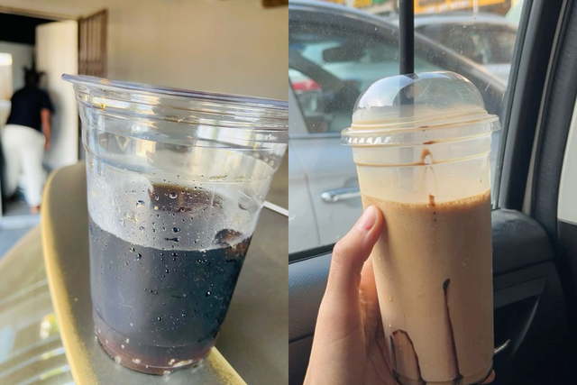 Người đàn ông rất chăm uống nước nhưng vẫn suy thận cấp, bác sĩ tức giận: "Nước này uống nhiều như thuốc độc"- Ảnh 2. Người đàn ông rất chăm uống nước nhưng vẫn suy thận cấp, bác sĩ tức giận: "Nước này uống nhiều như thuốc độc"- Ảnh 2.