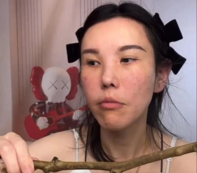 Mặt nữ mukbang biến dạng nghiêm trọng sau 2 năm hành nghề- Ảnh 2. Mặt nữ mukbang biến dạng nghiêm trọng sau 2 năm hành nghề- Ảnh 2.