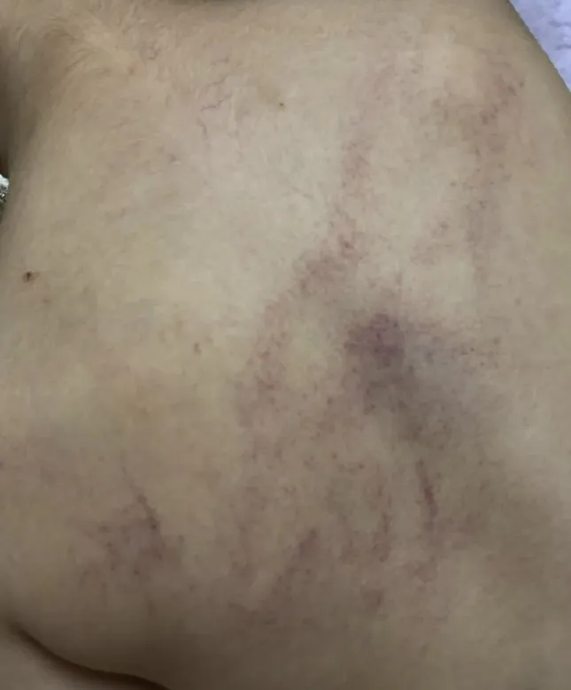 Bé 4 tuổi bị giáo viên bạo hành: Công an khám nghiệm hiện trường, đưa trẻ đi giám định thương tích- Ảnh 2. Bé 4 tuổi bị giáo viên bạo hành: Công an khám nghiệm hiện trường, đưa trẻ đi giám định thương tích- Ảnh 2.
