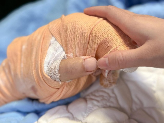 Nam TikToker ở Thái Nguyên bị chém gần đứt lìa bàn tay: Bác sĩ thông báo tin quan trọng- Ảnh 1. Nam TikToker ở Thái Nguyên bị chém gần đứt lìa bàn tay: Bác sĩ thông báo tin quan trọng- Ảnh 1.