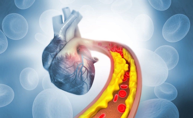 Thực phẩm có cholesterol cao gấp 3 lần mỡ lợn, cực hại nếu ăn nhiều: Người Việt rất hay ăn- Ảnh 1. Thực phẩm có cholesterol cao gấp 3 lần mỡ lợn, cực hại nếu ăn nhiều: Người Việt rất hay ăn- Ảnh 1.