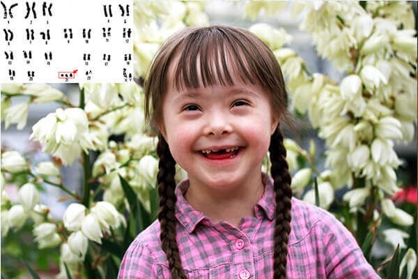 Kỳ tích y khoa Nhật Bản: Chỉnh sửa gen, loại bỏ thành công nhiễm sắc thể gây hội chứng Down- Ảnh 2. Kỳ tích y khoa Nhật Bản: Chỉnh sửa gen, loại bỏ thành công nhiễm sắc thể gây hội chứng Down- Ảnh 2.