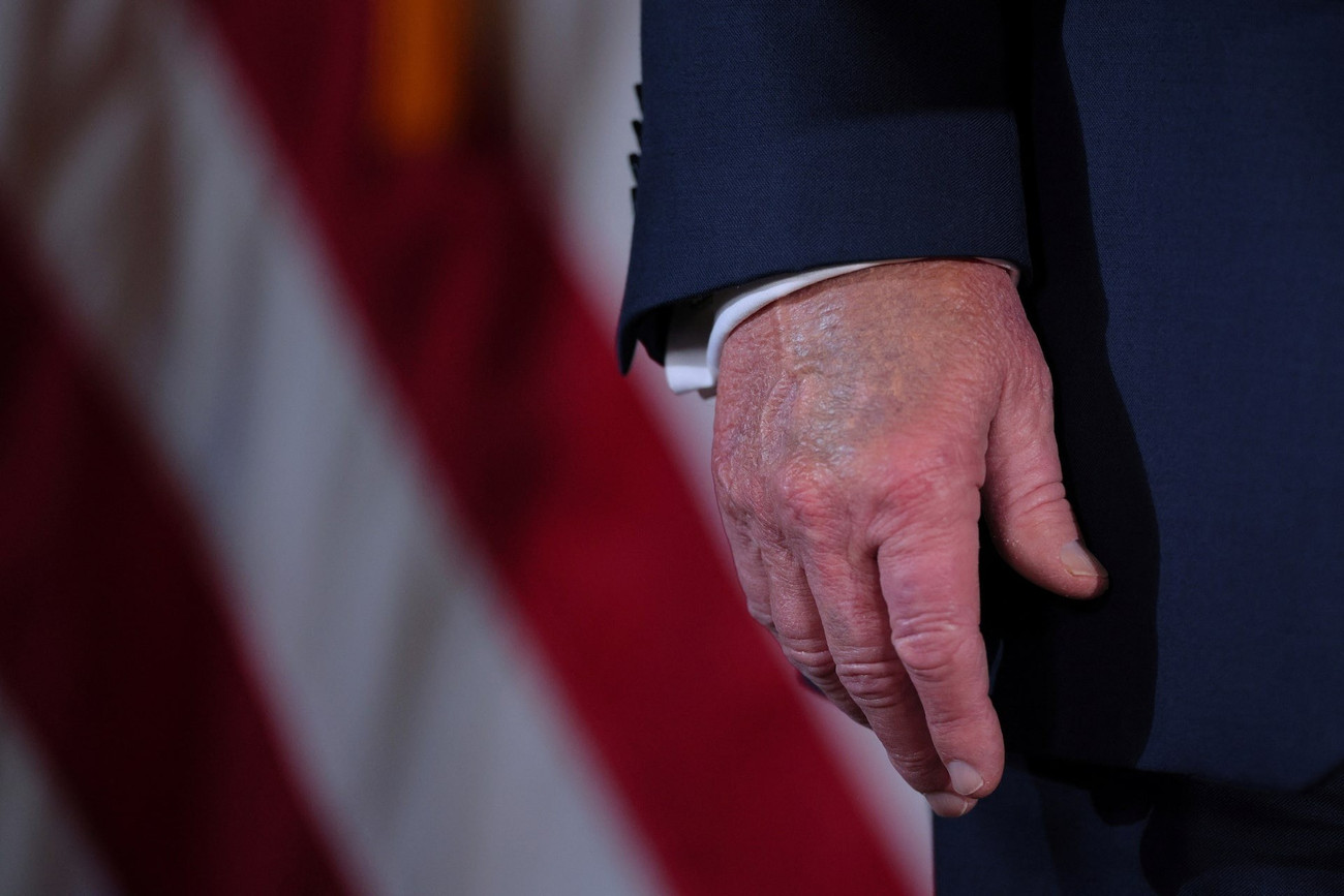 Nhà Trắng lên tiếng về sức khỏe của Tổng thống Mỹ Donald Trump- Ảnh 2. Nhà Trắng lên tiếng về sức khỏe của Tổng thống Mỹ Donald Trump- Ảnh 2.