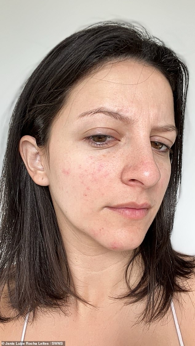 Chế độ ăn Carnivore là gì mà giúp cô gái 30 tuổi giảm được 9kg chỉ sau 1 tháng, da sạch mụn, hết rối loạn kinh nguyệt- Ảnh 1.