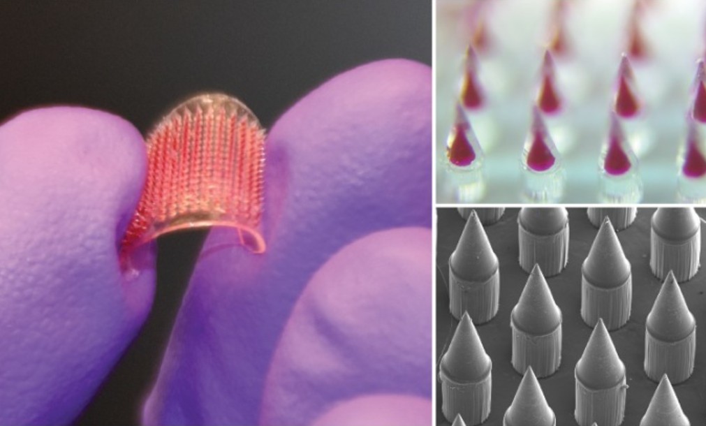 PGS&nbsp;Việt&nbsp;được Bill Gates đầu tư 6,6 triệu USD, báo Mỹ gọi là "ngôi sao": Tạo ra loại gel "phù thủy" tái tạo khớp gối, bệnh nhân không cần mổ- Ảnh 3.