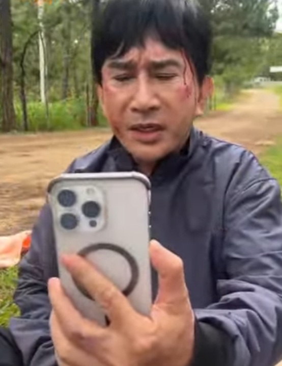 NSƯT Kim Tử Long gặp chấn thương, cả đoàn phim phải ngưng quay- Ảnh 1. NSƯT Kim Tử Long gặp chấn thương, cả đoàn phim phải ngưng quay- Ảnh 1.