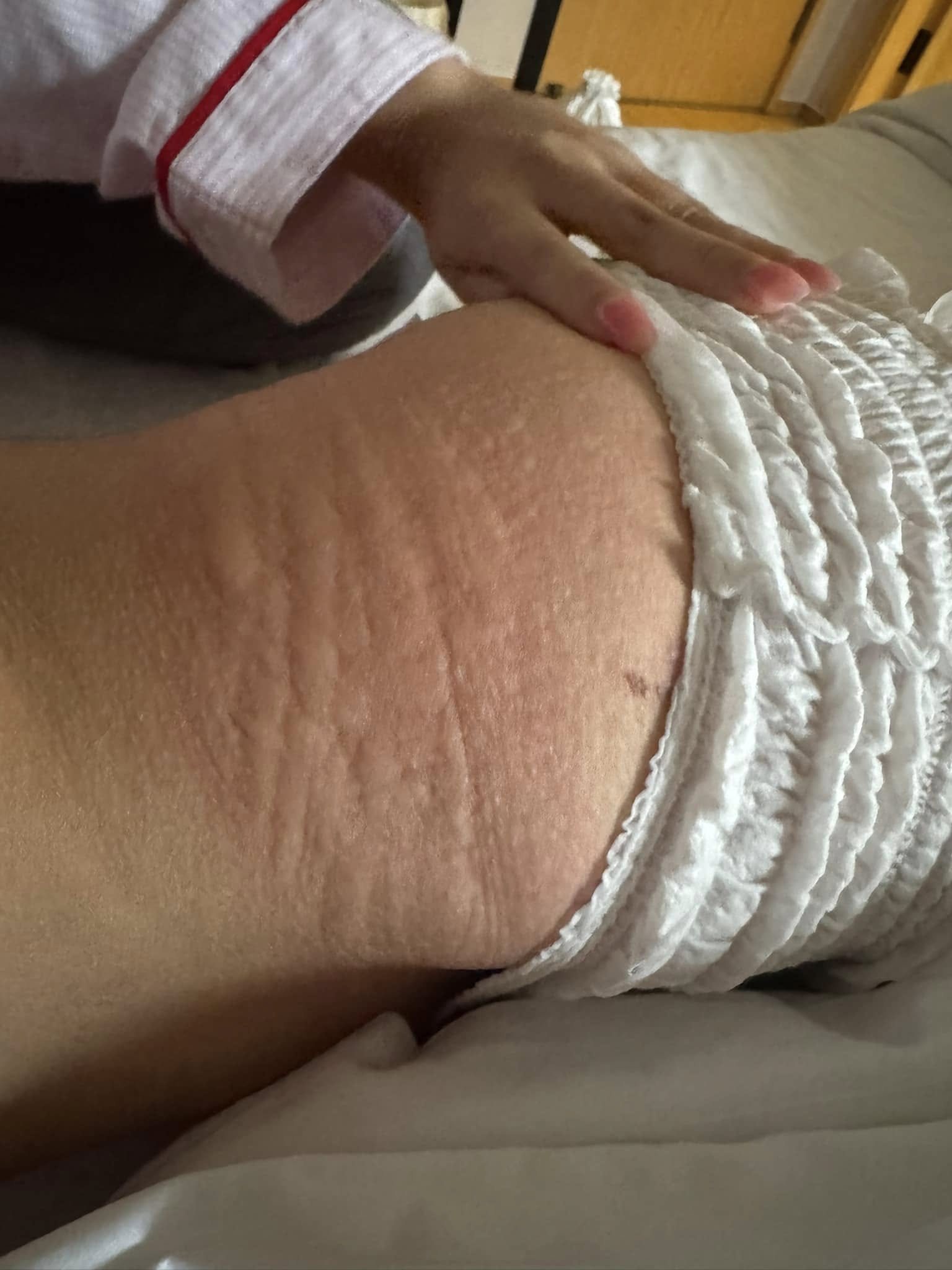 Phương Mỹ Chi gặp nguy, bác sĩ cũng đành bó tay- Ảnh 5. Phương Mỹ Chi gặp nguy, bác sĩ cũng đành bó tay- Ảnh 5.