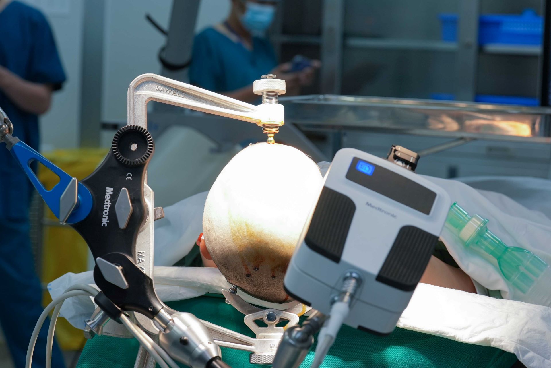 Bệnh viện của tỷ phú Phạm Nhật Vượng tiên phong điều trị động kinh bằng Robot AutoGuide: Tạo đột phá y học với công nghệ hàng đầu thế giới- Ảnh 1. Bệnh viện của tỷ phú Phạm Nhật Vượng tiên phong điều trị động kinh bằng Robot AutoGuide: Tạo đột phá y học với công nghệ hàng đầu thế giới- Ảnh 1.