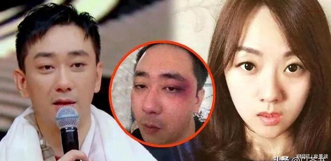 Nam MC kêu cứu vì bị vợ bạo hành hơn 100 lần, 8 lần trọng thương nhập viện!- Ảnh 4. Nam MC kêu cứu vì bị vợ bạo hành hơn 100 lần, 8 lần trọng thương nhập viện!- Ảnh 4.